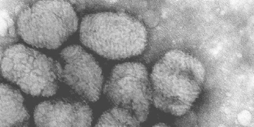 Life before vaccines: Smallpox