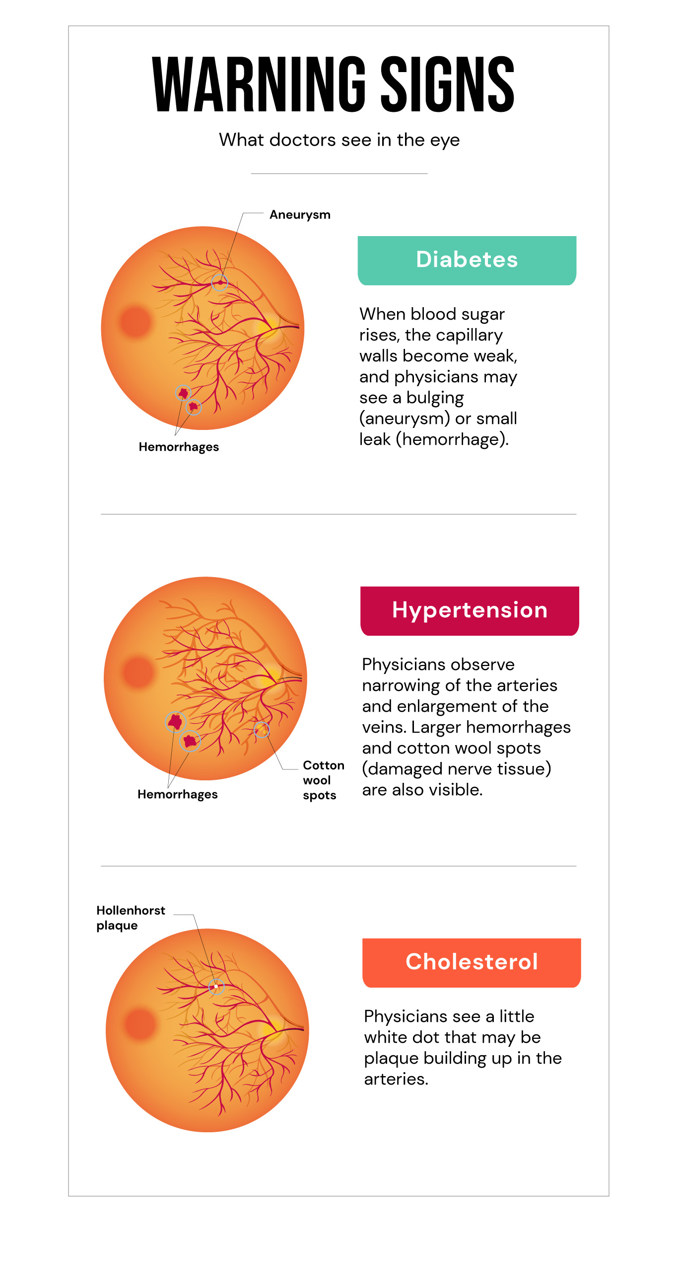 Eye Infographic