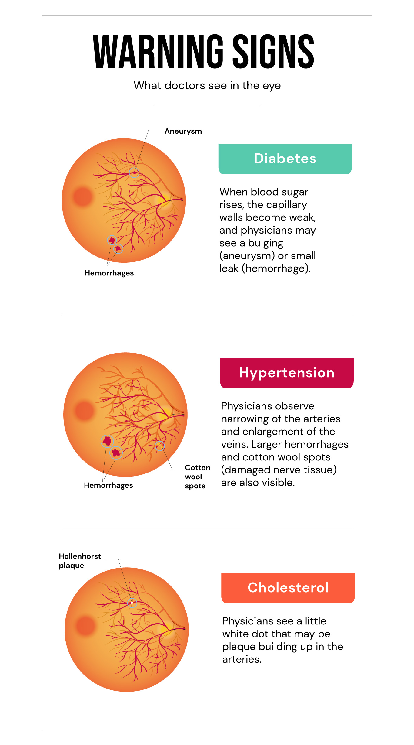 Eye infographic